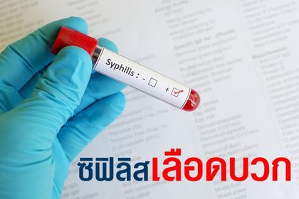 ซิฟิลิส เลือดบวก