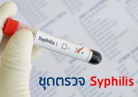 ชุดตรวจ Syphilis