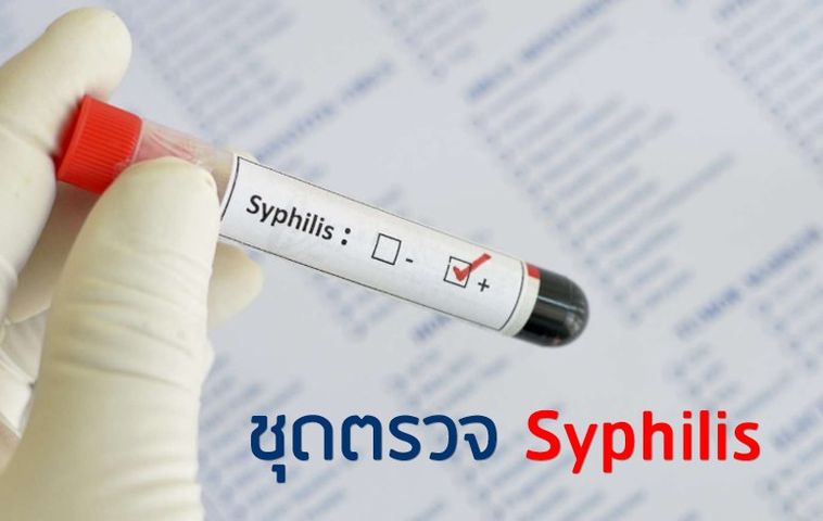 ชุดตรวจ Syphilis