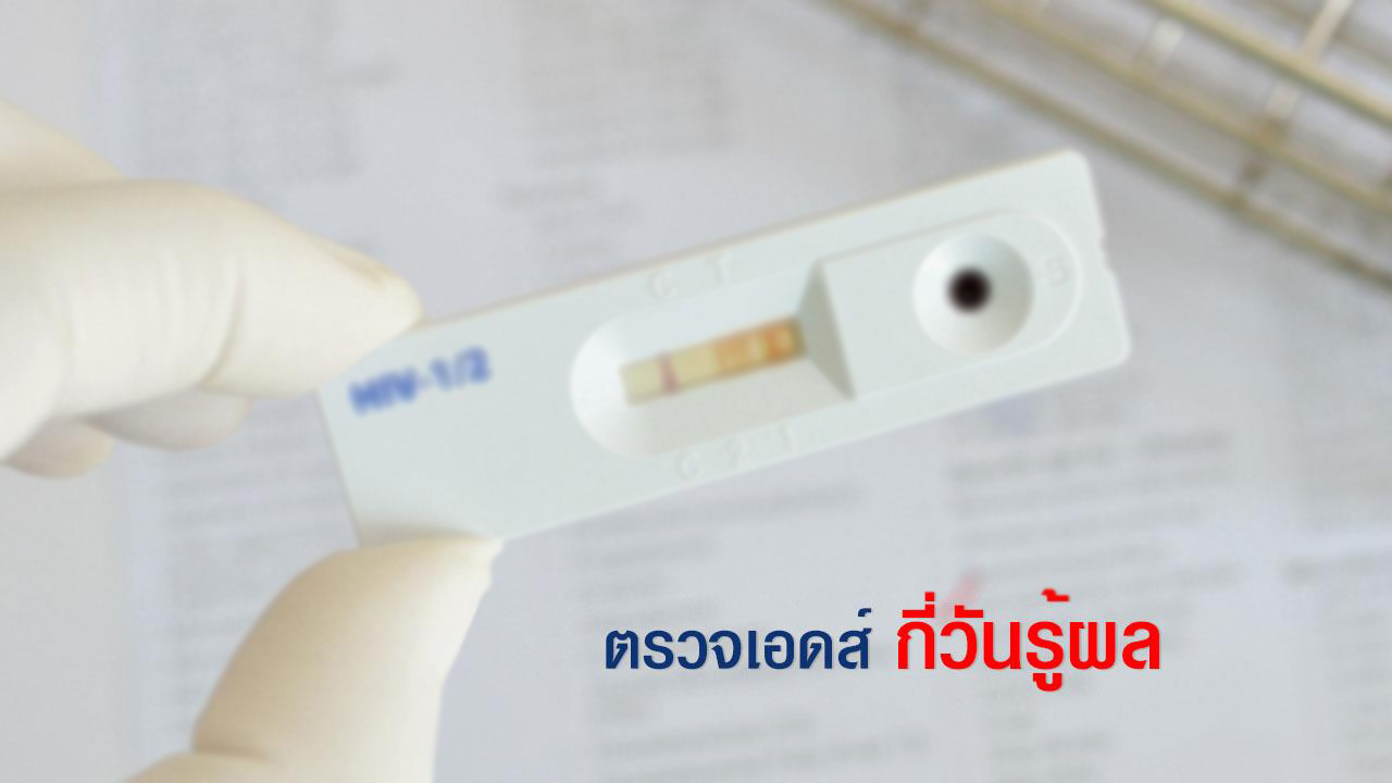 ตรวจเอดส์ กี่วันรู้ผล