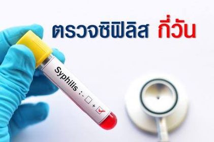 ตรวจซิฟิลิส กี่วัน