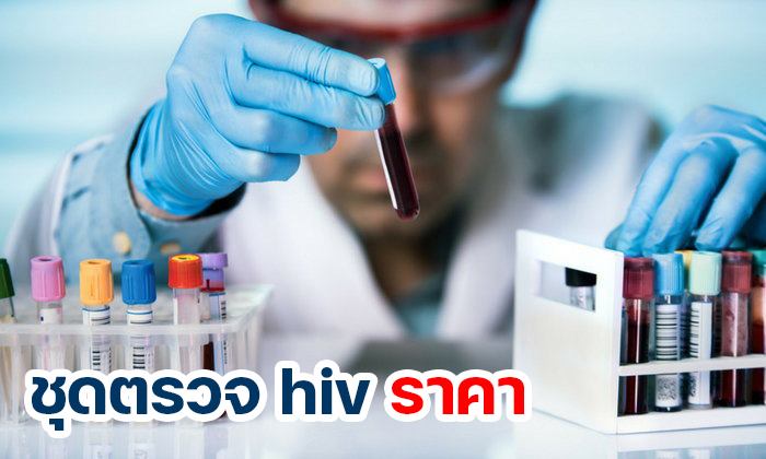 ชุดตรวจ HIV ราคา