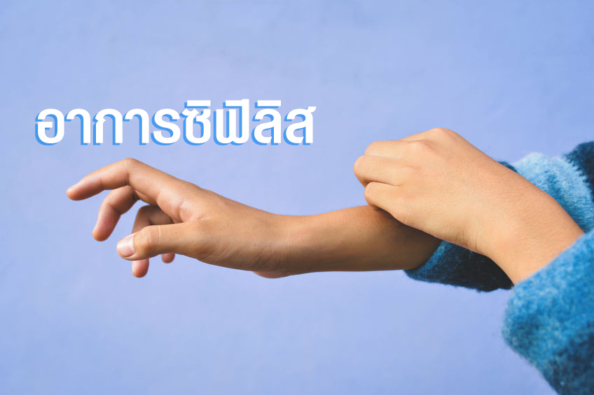 อาการซิฟิลิส