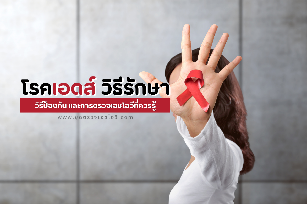 โรคเอดส์ วิธีรักษา