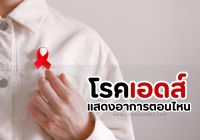 โรคเอดส์ แสดงอาการ ตอน ไหน