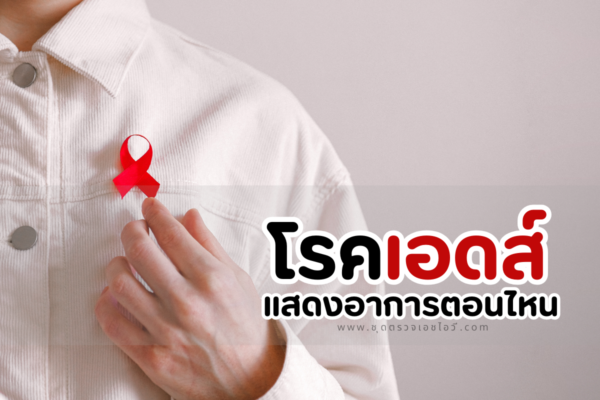 โรคเอดส์ แสดงอาการ ตอน ไหน